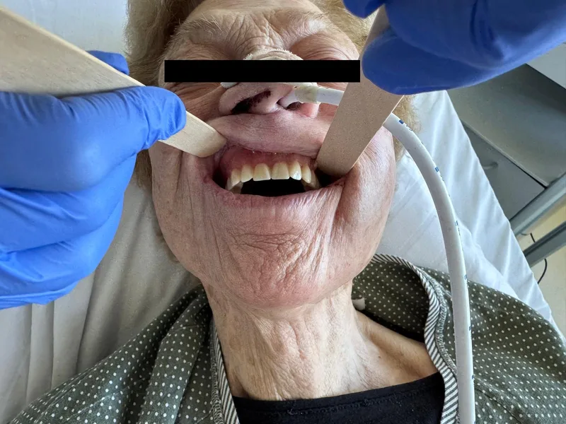 Abb. 4: Patientin postoperativ mit eingegliederter Wundschutzprothese.
Die Ernährung erfolgt in den ersten Tagen nasogastral.