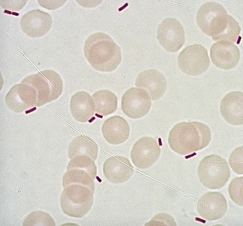 Fig. 2: Gram-negative Rods Frequently Exhibit Multidrug Resistance to Antibiotics (Image: BwKrhs Hamburg/Dept. XXI)