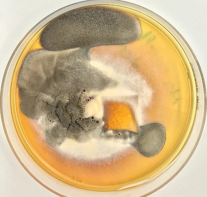 Fig. 4: Eumycetoma: Slow growth of dark colonies consistent with Madurella mycetomatis (Image rights: Department of Dermatology, BwKrhs Hamburg)