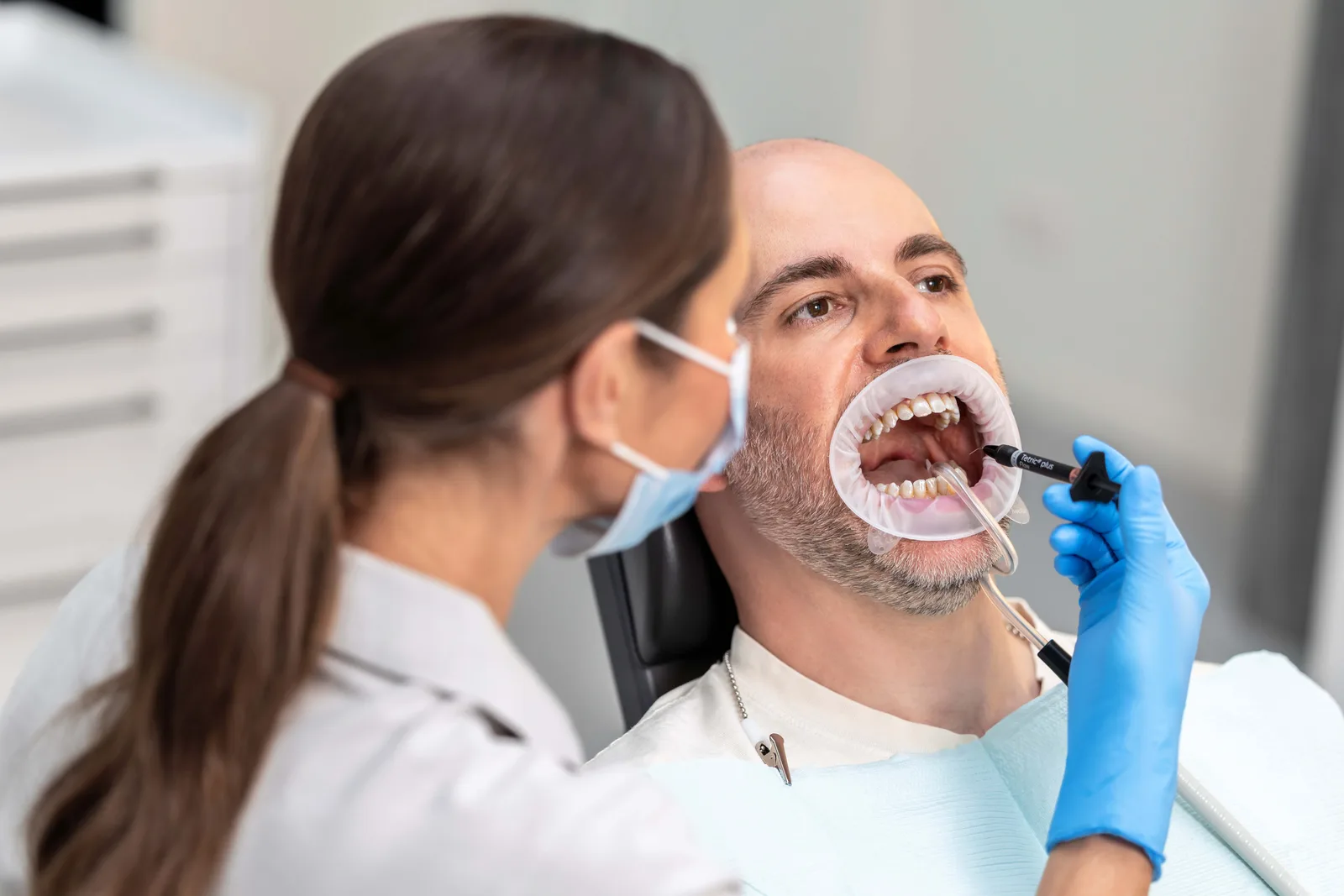 Zahnärztliche Behandlung mit Tetric plus Flow von Ivoclar unter Verwendung eines Lippen-Wangen-Abhalters und einer Absaugkanüle